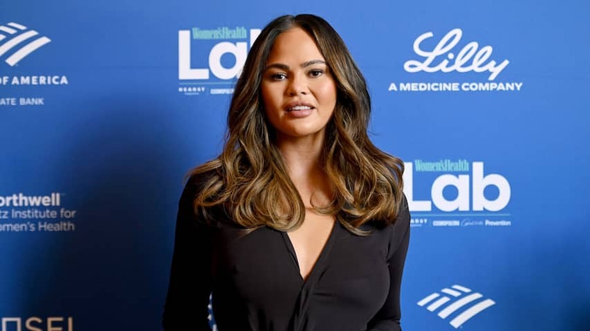 Chrissy Teigen has lowered hairline: 'It became very thin above'