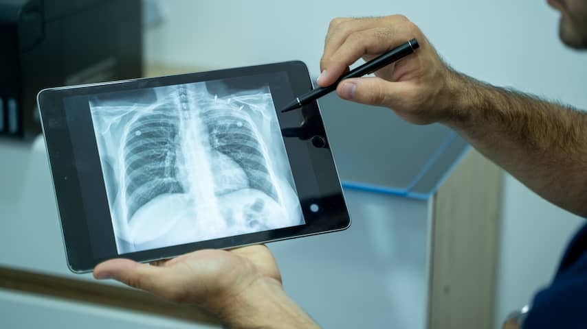 Eleven cases of tuberculosis in Arnhem, mainly under the homeless